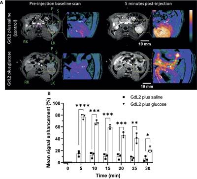 Imaging β-Cell Function Using a Zinc-Responsive MRI Contrast Agent May Identify First Responder Islets